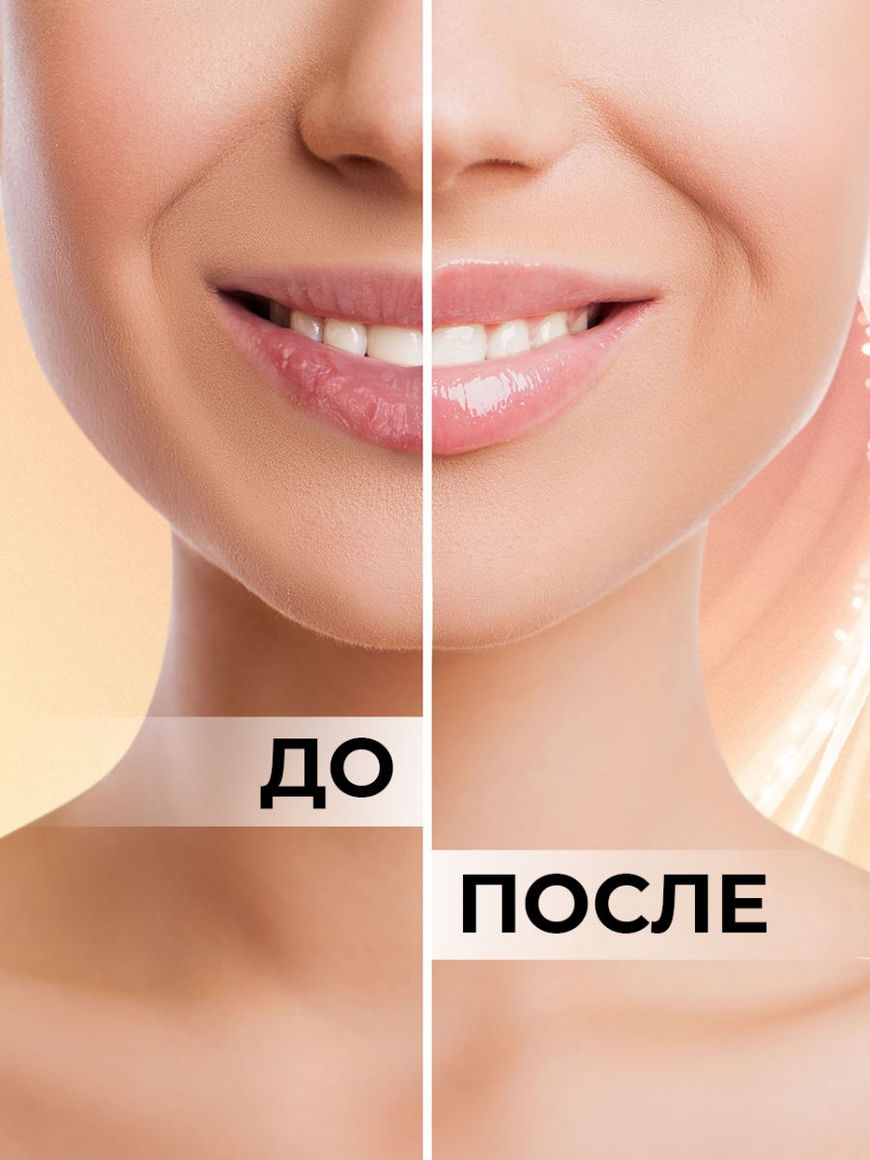 Патчи для губ как использовать. Патчи для губ для чего. Патчи для увеличения объема губ. Патчи для губ увеличивающие объем. Патчи для губ увеличивают губы.